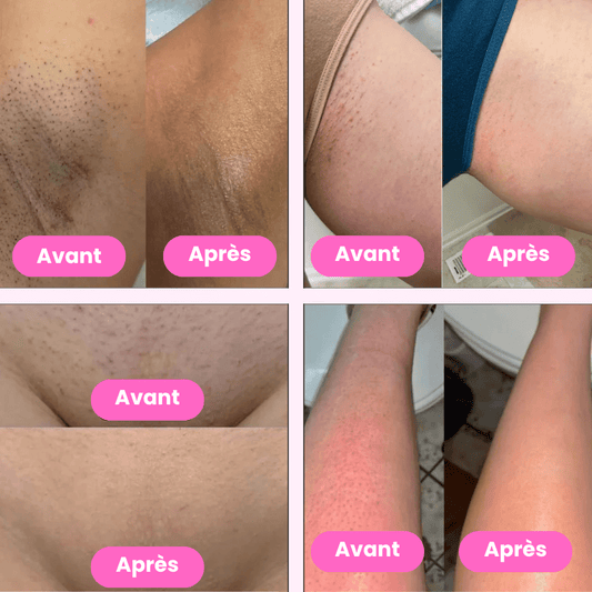 Lady Shaver • Épilateur Électrique